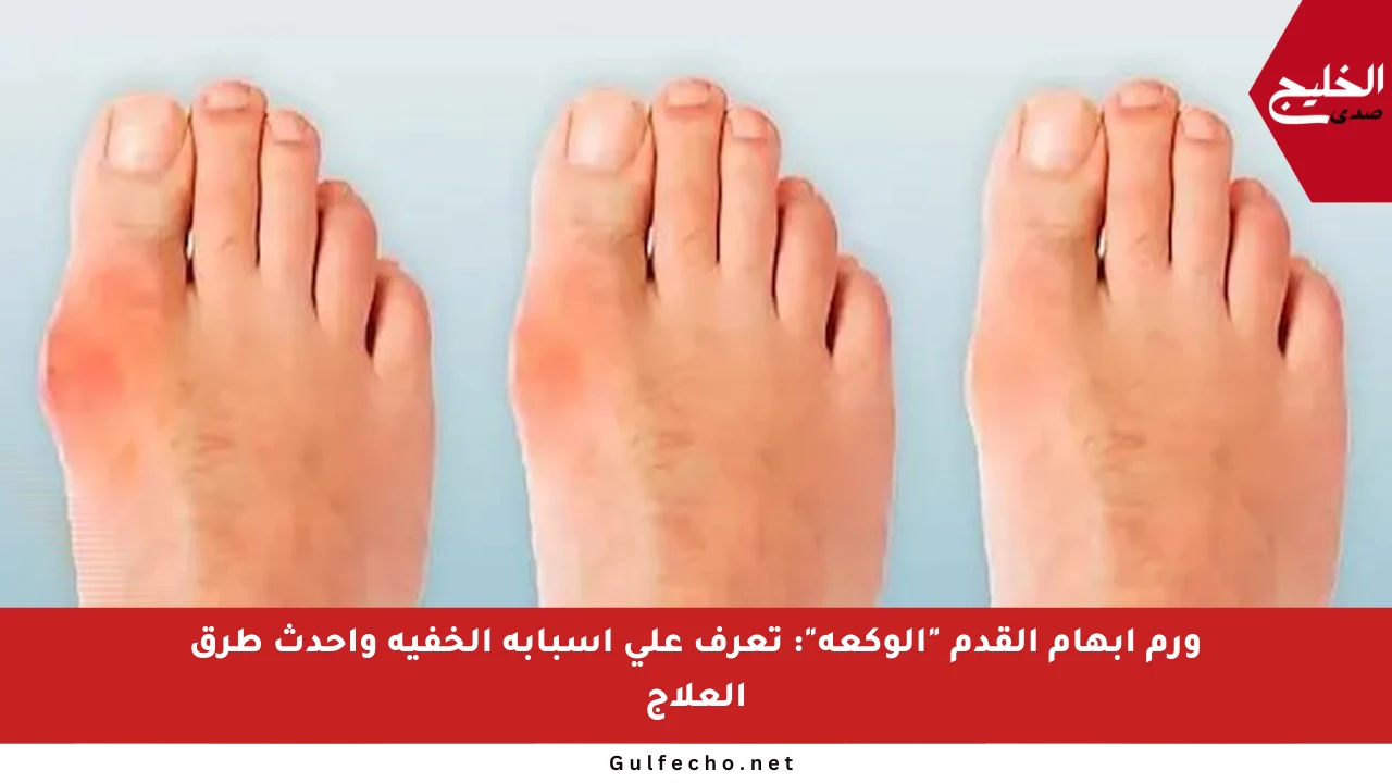 ورم إبهام القدم “الوكعة”: تعرف على أسبابه الخفية وأحدث طرق العلاج